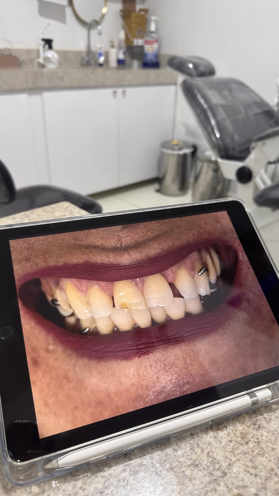 Consultório com o planejamento do sorriso de uma paciente em um tablet